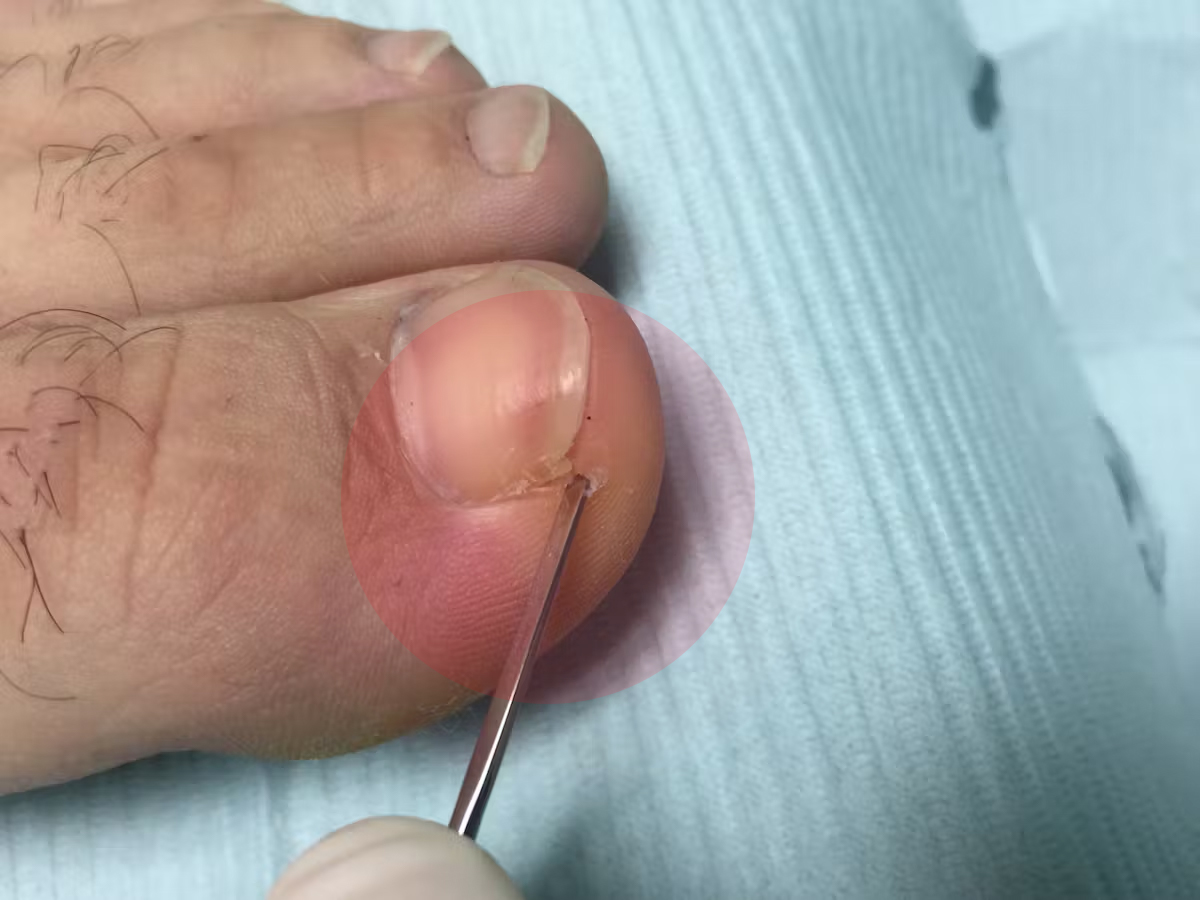 Service de couple d'ongle incarné