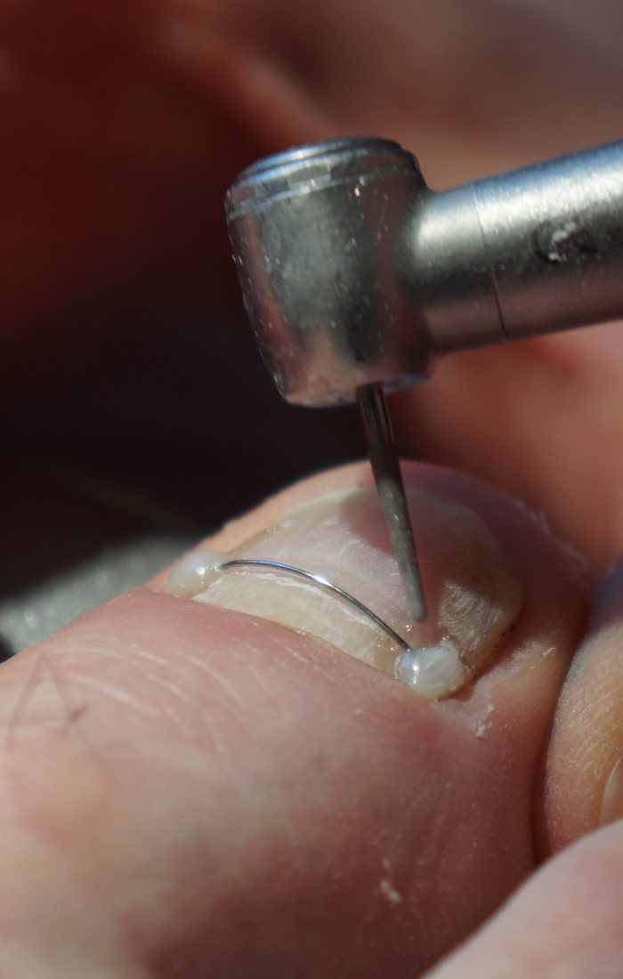 Service de couple d'ongle incarné
